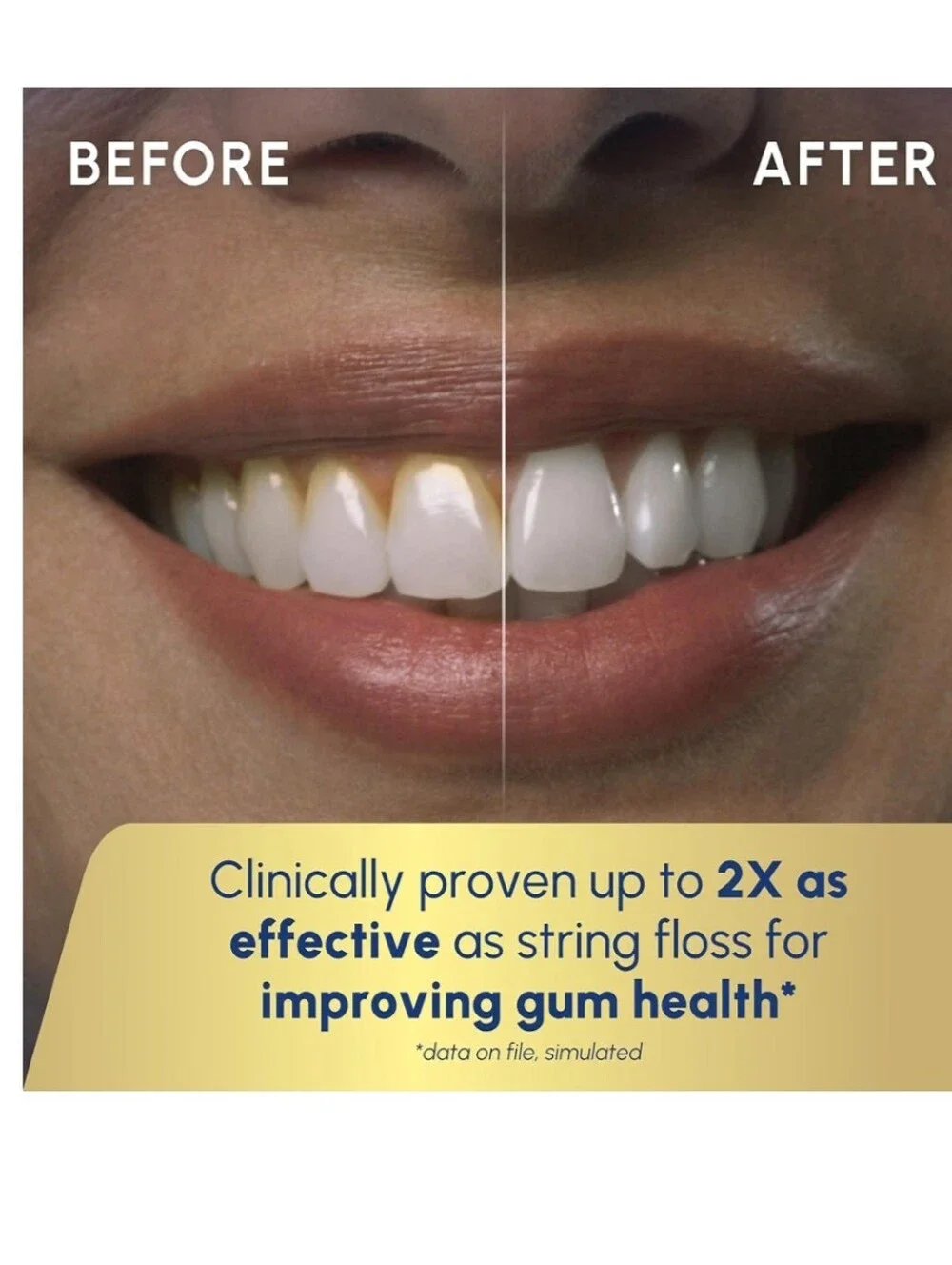 Waterpik Cordless Gem Water Flosser